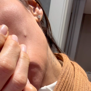 Deformações no rosto de Maíra Cardi é semelhante a uma espinha. Em seu vídeo, a influenciadora deixou um recado importante aos fãs