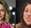 Antes e depois de Juliana Knust: atriz também passou por transplante capilar em decorrência de alopecia androgenética