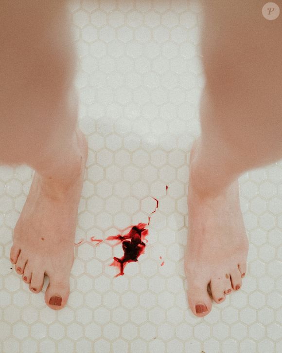 Os principais riscos incluem infecções bacterianas e fúngicas, dermatite de contato, inflamação e agravamento de condições como acne, rosácea e peles sensíveis