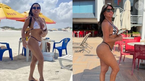 Gretchen fez aplicação de PMMA no bumbum