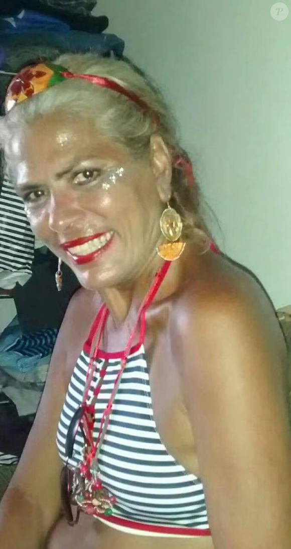 Tragédia! Morre Lia Hollywood, ex-chacrete atacada por pitbull do próprio filho no Rio; outras vítimas pediram medidas protetivas contra o dono