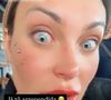 Andressa Urach disse estar arrependida, com medo de ficar cega e pediu orações na web