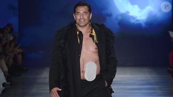 Bolsas de colostomia e ileostomia apresentam a mesma função e são implantadas em diversos tratamentos. Luciano Szafir precisou fazer uso de uma após contrair Covid-19