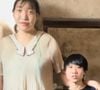 Casamento marcado por 53 cm de diferença: morre aos 26 anos influenciadora chinesa com 2,18m de altura que viralizou por relação com homem mais baixo; Xiao Yue teve diagnóstico de tumor na hipófise e um meningioma
