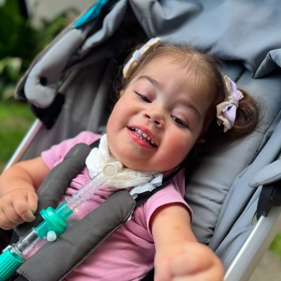 Filha de Juliano Cazarré, Maria Guilhermina ficou com sequela após diagnóstico de doença rara no coração