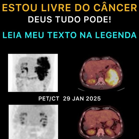 Equipe médica recomendou continuidade do protocolo para consolidar o resultado positivo