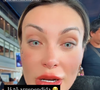 Andressa Urach: ‘Meus olhos estão doendo bastante. Vou ter que ir no médico, porque está doendo muito’