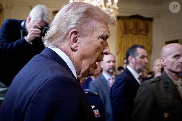 O que é o hematoma no pescoço de Donald Trump, de 79 anos? Presidente dos EUA passa por 'tratamento', mas médico não entrou em detalhes