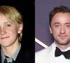 Antes e depois do ator Tom Feltonm de 'Harry Potter'