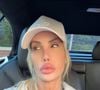 Ex-reality, Nikki Exotika está em estado grave após longa cirurgia no coração
