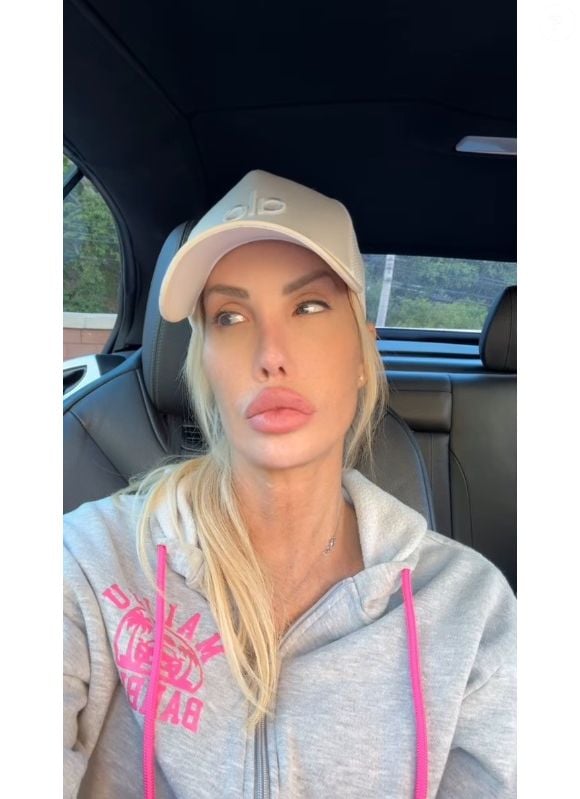 Ex-reality, Nikki Exotika está em estado grave após longa cirurgia no coração