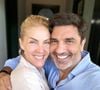 Ana Hickmann está noiva de Edu Guedes.