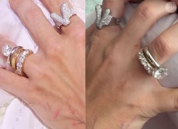 Virgínia deixa de usar aliança de casamento com Zé Felipe