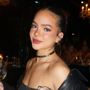 Adeus rugas! Botox antes dos 30 fez parte da rotina dessas 15 famosas e talvez você não saiba