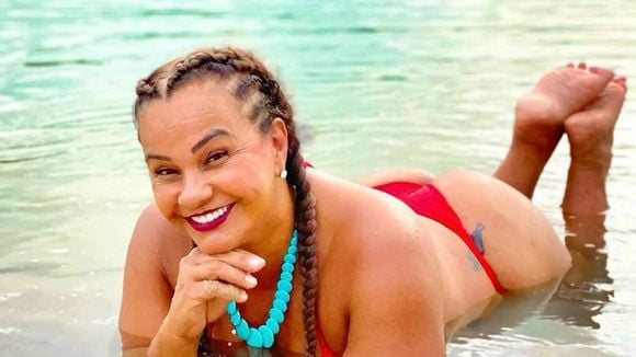 'A segurança sempre vem antes do desejo estético': especialista alerta sobre riscos de combo de cirurgias de Solange Couto, do 'BBB 26'