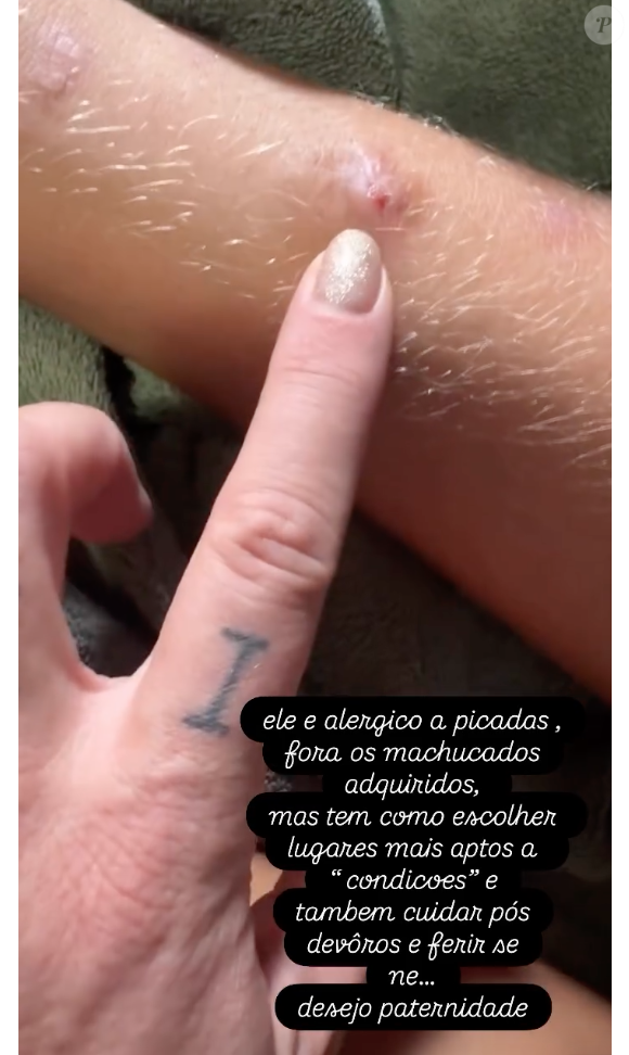 Luana Piovani ainda criticou o fato de um dos filhos que, apesar de não ter citado, pode se tratar de Bem, que estava repleto de machucados