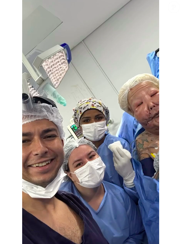 Dr. Thiago Marra explicou que Juju do Pix precisará fazer mais procedimentos em seu rosto