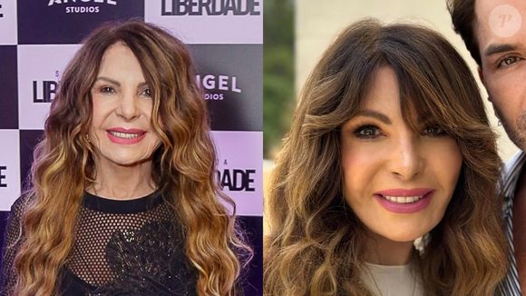 Antes e depois de Elba Ramalho: cantora não disse o que fez, mas rejuvenesceu muito com técnica aplicada no rosto
