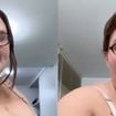 Antes e depois de Thais Carla: com 50 kg a menos, influenciadora mostra como está o corpo após bariátrica e revela lesão: 'Não posso fazer nada'