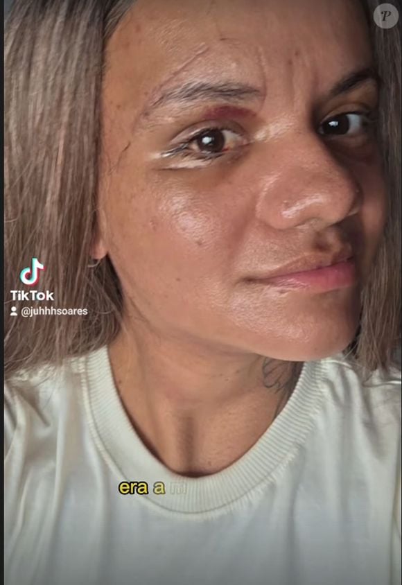 Juliana Soares foi agredida pelo então namorado Igor Eduardo Pereira Cabral, ex-jogador de basquete