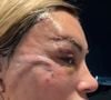 Andressa Urach surgiu irreconhecível em sua rede social