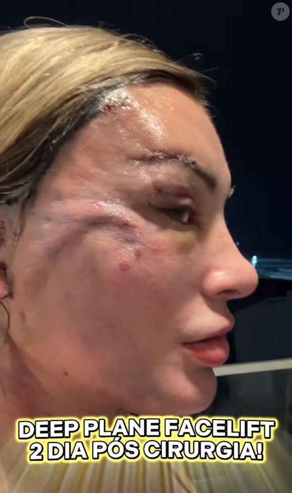 Andressa Urach surgiu irreconhecível em sua rede social