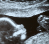 'A lei não exige que o bebê nasça com vida', explica advogada sobre os direitos de mães que enfrentam perdas gestacionais após o sexto mês