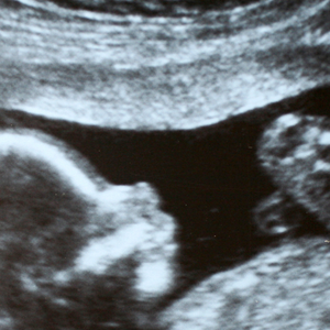 'A lei não exige que o bebê nasça com vida', explica advogada sobre os direitos de mães que enfrentam perdas gestacionais após o sexto mês