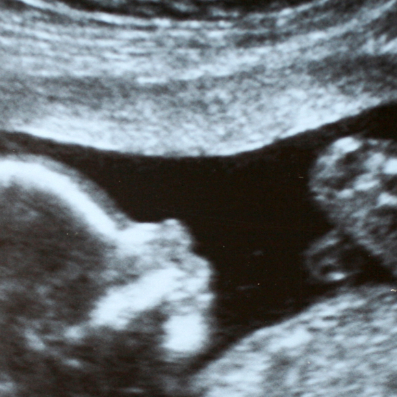 'A lei não exige que o bebê nasça com vida', explica advogada sobre os direitos de mães que enfrentam perdas gestacionais após o sexto mês