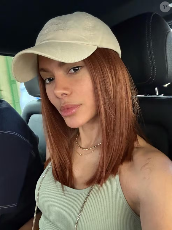 O rosto da cantora, visivelmente modificado, gerou uma onda de especulações sobre possíveis intervenções estéticas.