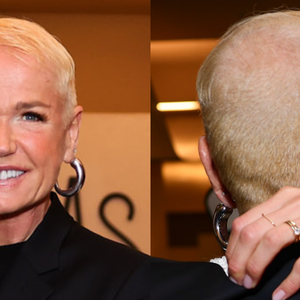 Após revelar doença genética, Xuxa confessa que fez transplante capilar e quer voltar a usar 'xuquinhas' em turnê: 'Só queria ter um cabelinho legal'