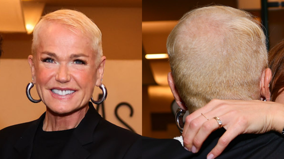 Após revelar doença genética, Xuxa confessa que fez transplante capilar e quer voltar a usar 'xuquinhas' em turnê: 'Só queria ter um cabelinho legal'