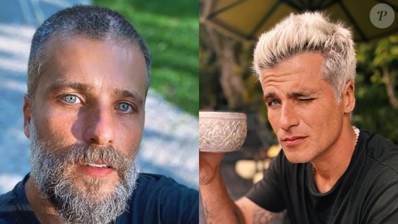 Bruno Gagliasso é mais um famoso que apostou no transplante capilar e escolheu uma técnica inovadora que não deixa cicatrizes