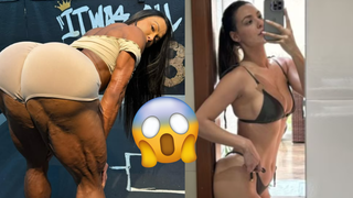 Nem Gracyanne Barbosa, nem Bia do Brás: ex-BBB revela cirurgia plástica nos seios que 'deu ruim' e admite uso de ‘bomba’