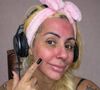 Débora Dunhill sofreu com vermelhidão e irritação no rosto instantes após o aplicar o sangue