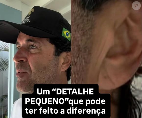 Com a repercussão da morte repentina do influenciador, o assunto ganhou destaque na mídia e chamou a atenção do cardiologista Dr. Alan Max: o médico compartilhou um sinal que percebeu na orelha de Henrique e que poderia ter evitado um final trágico.