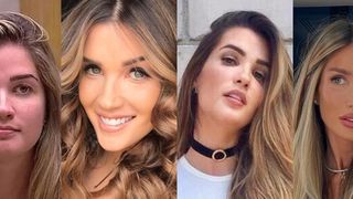 Antes e depois de Aline Gotschalg: 10 anos após o 'BBB', famosa emagreceu 10 kg, fez procedimentos no rosto e está irreconhecível. Veja 30 fotos!