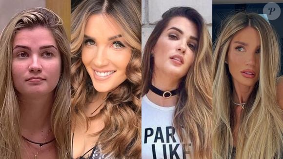 Antes e depois de Aline Gotschalg em 30 fotos: ex-BBB emagreceu 10 kg, fez procedimentos no rosto e está irreconhecível