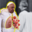 Papa Francisco tem apenas um pulmão? Idade e histórico de saúde preocupam fiéis