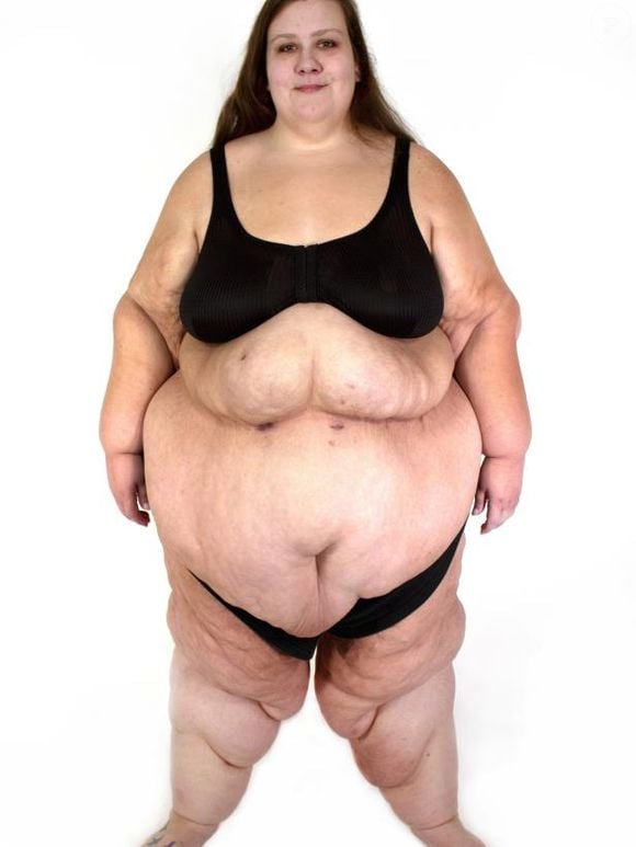 Lacey terminou o 'Quilos Mortais' pesando 197 kg, marcando sua perda de 116 quilos após a bariátrica