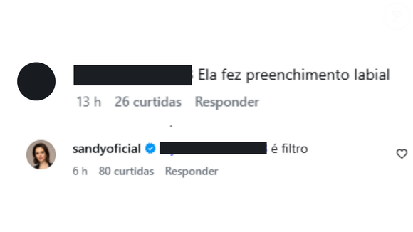 Sandy decidiu desmentir o procedimento. ‘É filtro’, garantiu