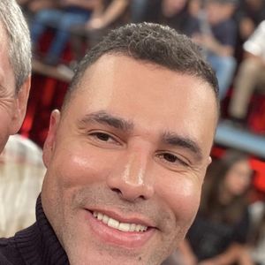 Mudança mais polêmica do rosto de Rodrigo Sant'Anna foi sua harmonização facial