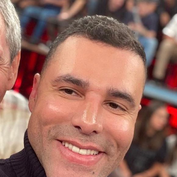 Mudança mais polêmica do rosto de Rodrigo Sant'Anna foi sua harmonização facial