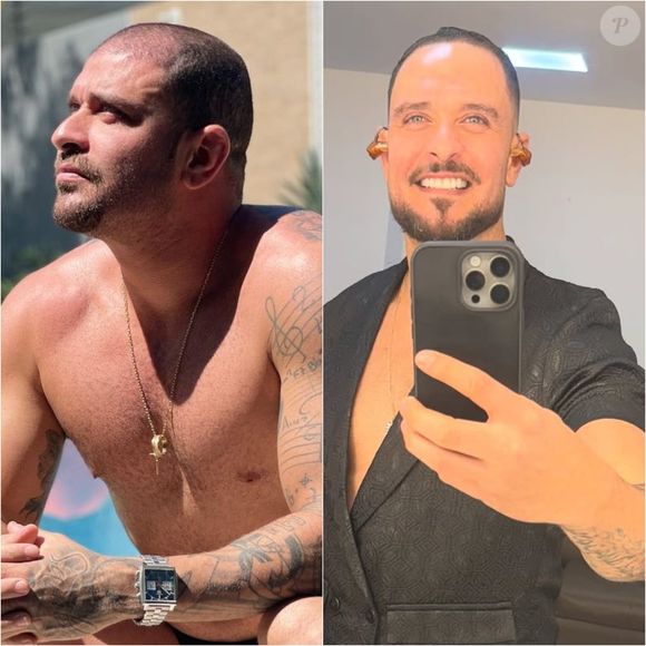 Antes e depois de Diogo Nogueira: namorado de Paolla Oliveira passou por mudança no visual ao implantar cabelo