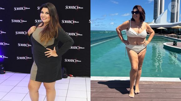 A atriz Fabiana Karla emagreceu 20 kg após a cirurgia bariátrica, feita em dezembro de 2010