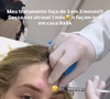 Tratamento com botox ganha destaque após relato de Virgínia Fonseca sobre enxaqueca intensa