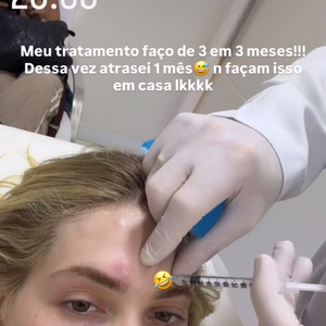 Tratamento com botox ganha destaque após relato de Virgínia Fonseca sobre enxaqueca intensa