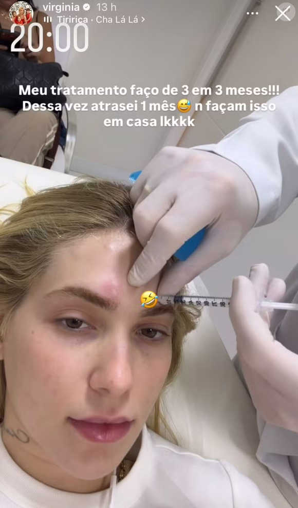 Tratamento com botox ganha destaque após relato de Virgínia Fonseca sobre enxaqueca intensa