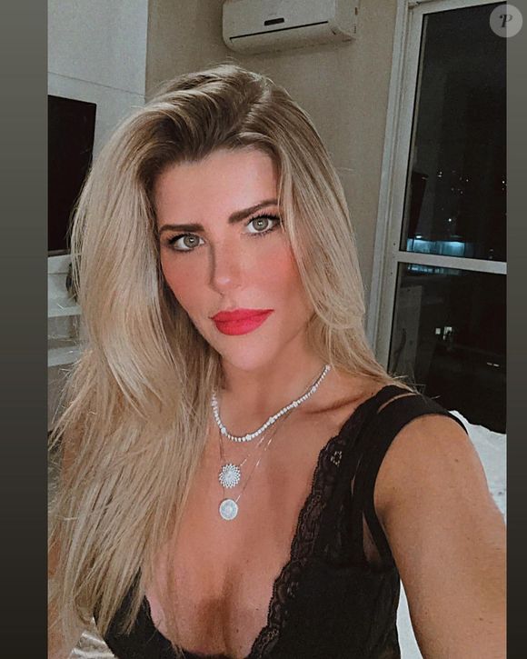 Íris Stefanelli também fez um preenchimento labial para dar mais volume