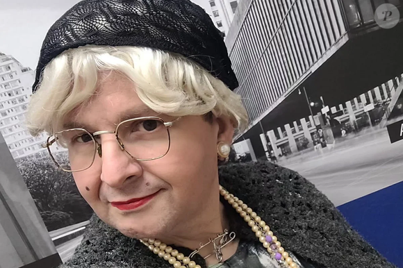 Nos stories, o humorista contou que o susto foi grande e que a amputação foi necessária para salvar sua vida. "Esse vídeo é pra falar pra você que eu tô bem. Eu passei um susto muito grande, eu tive um medo muito grande por causa da minha amputação", iniciou.